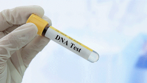 Pentingnya Lakukan Tes DNA Bagi Perawatan Kecantikan