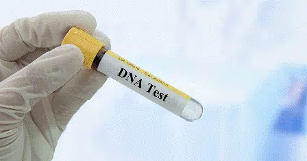 Pentingnya Lakukan Tes DNA Bagi Perawatan Kecantikan
