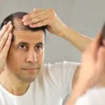 5 Makanan Ini bisa Mencegah Kebotakan pada Rambut Anda