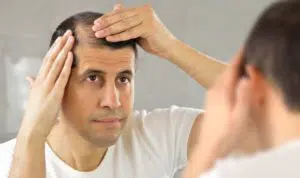 5 Makanan Ini bisa Mencegah Kebotakan pada Rambut Anda