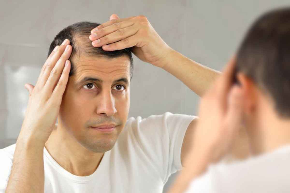 5 Makanan Ini bisa Mencegah Kebotakan pada Rambut Anda