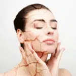 Pakai Sulfur Bisa Bikin Kulit Kering, Benarkah?
