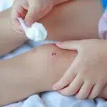 Bolehkah Membersihkan Luka dengan Sabun? Cek Disini