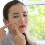 5 Jenis Jerawat Ini Bisa Disamarkan dengan Penggunaan Concealer, Begini Caranya