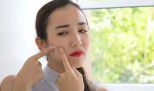 5 Jenis Jerawat Ini Bisa Disamarkan dengan Penggunaan Concealer, Begini Caranya