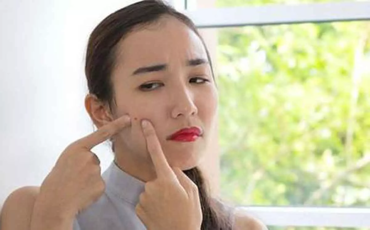 5 Jenis Jerawat Ini Bisa Disamarkan dengan Penggunaan Concealer, Begini Caranya
