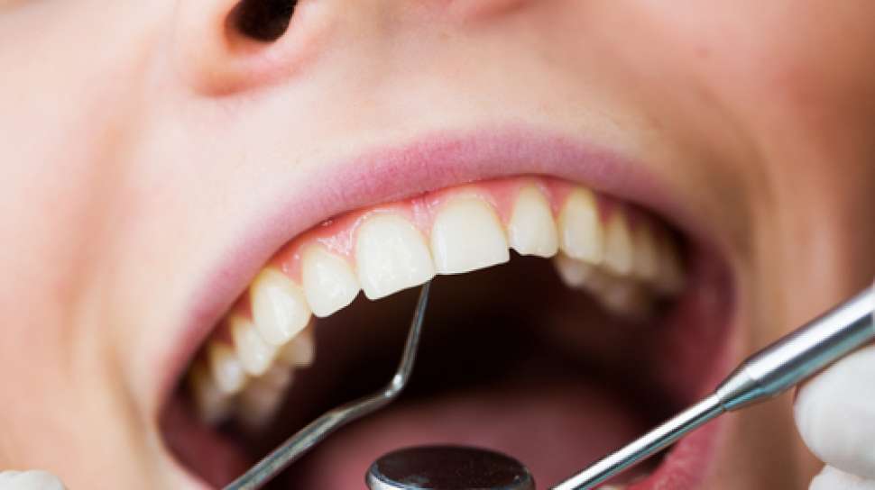 Kenali 5 Kerusakan Gigi Saat Usia 30-an