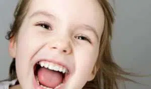 5 Cara Merawat Gigi Bayi agar Tetap Sehat