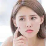 4 Cara Cepat Samarkan Noda Hitam di Wajah