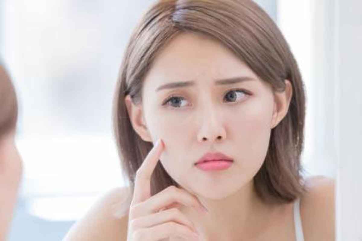 4 Cara Cepat Samarkan Noda Hitam di Wajah