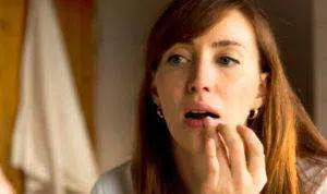 6 Cara Atasi Bibir Kering dan Pecah-pecah Menurut Dokter Kulit