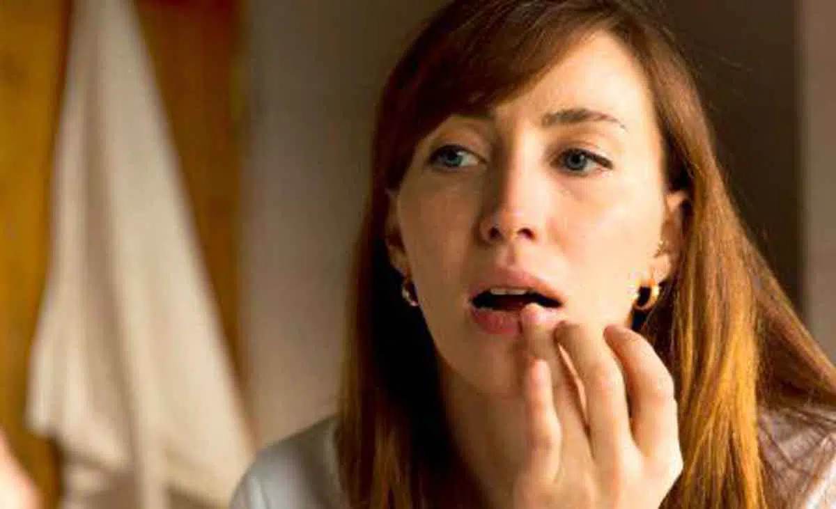 6 Cara Atasi Bibir Kering dan Pecah-pecah Menurut Dokter Kulit