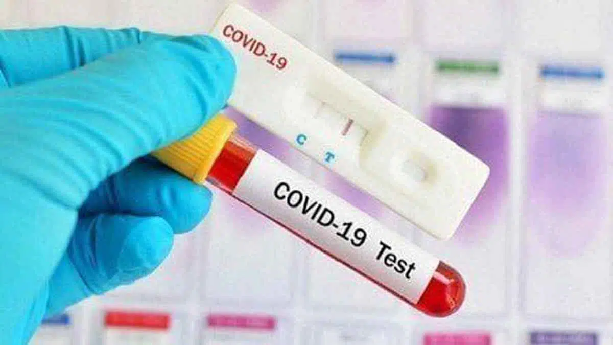 Hasil Rapid Test, Satpam Pasar Rongtengah Sampang Positif Covid-19