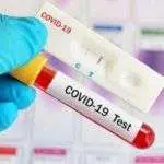 Hasil Rapid Test, Satu Pejabat Sumenep Reaktif