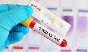 Hasil Rapid Test, Satpam Pasar Rongtengah Sampang Positif Covid-19