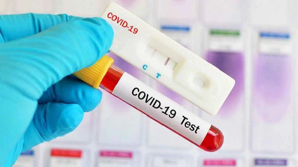 Hasil Rapid Test, Satpam Pasar Rongtengah Sampang Positif Covid-19