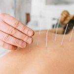 Manfaat Pengobatan Akupunktur Bagi Kesehatan Tubuh Anda