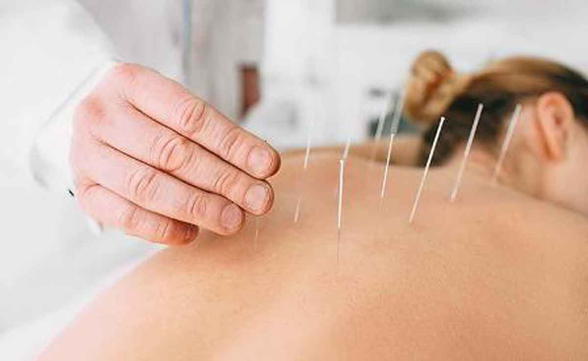 Manfaat Pengobatan Akupunktur Bagi Kesehatan Tubuh Anda