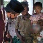 Bocah 6 Tahun Tanpa Anus, Hidup Bersama Ayahnya di Gubuk Bambu