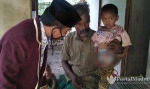 Bocah 6 Tahun Tanpa Anus, Hidup Bersama Ayahnya di Gubuk Bambu