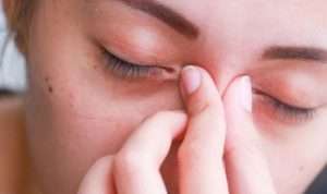 Berikut Tips Hilangkan Mata Sembap