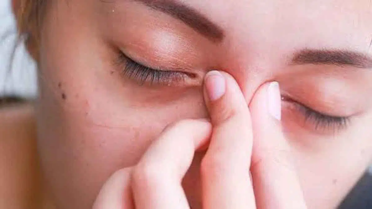 Berikut Tips Hilangkan Mata Sembap
