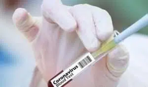 vaksin covid 19 corona