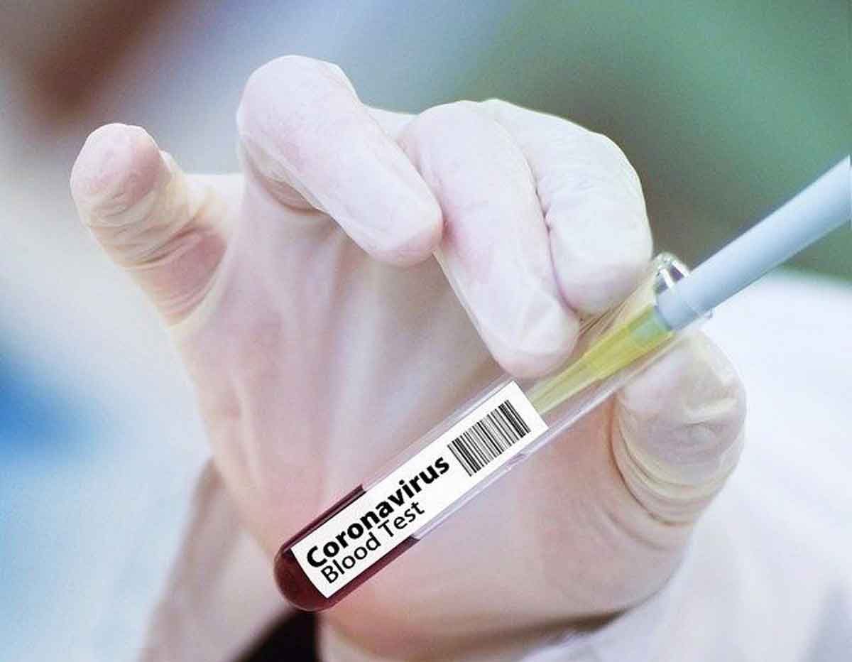 vaksin covid 19 corona