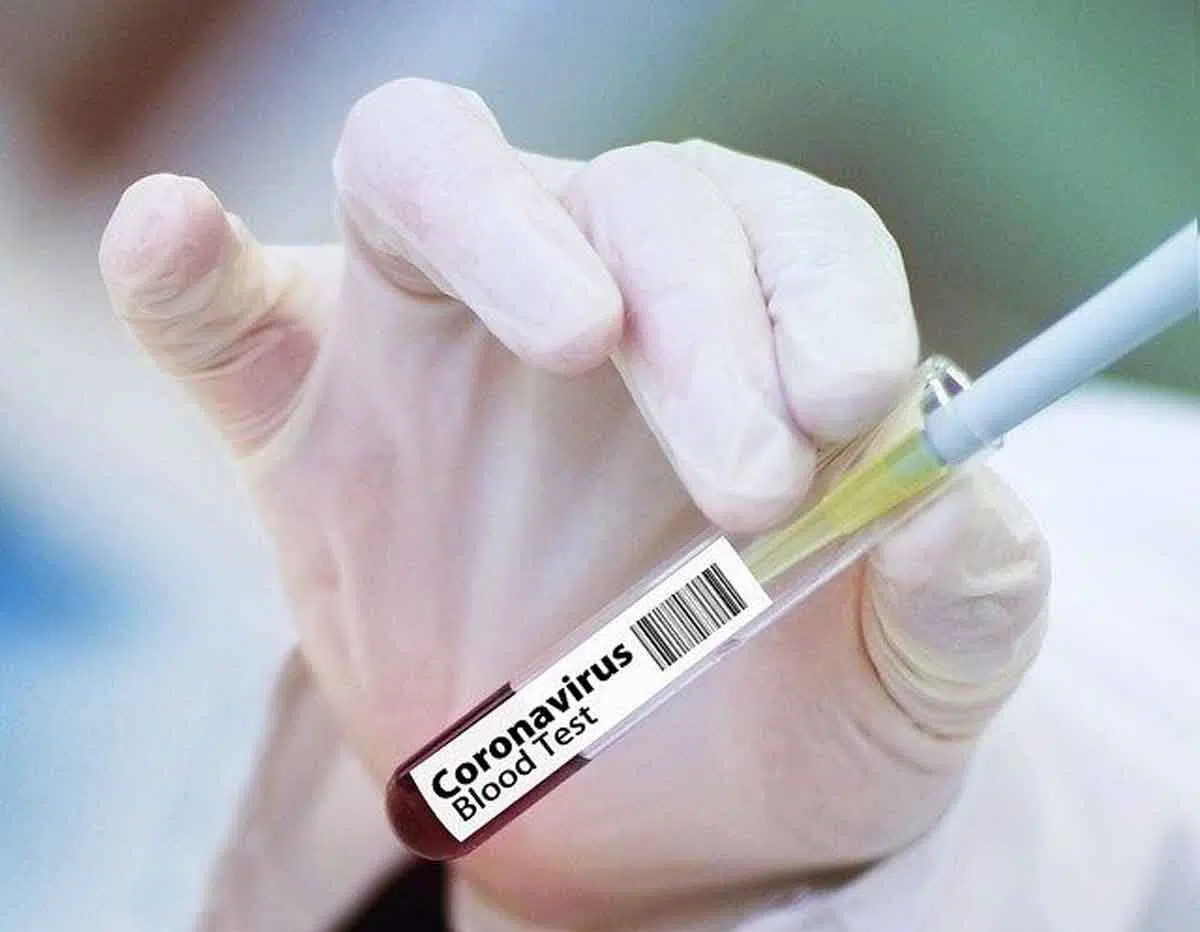 vaksin covid 19 corona