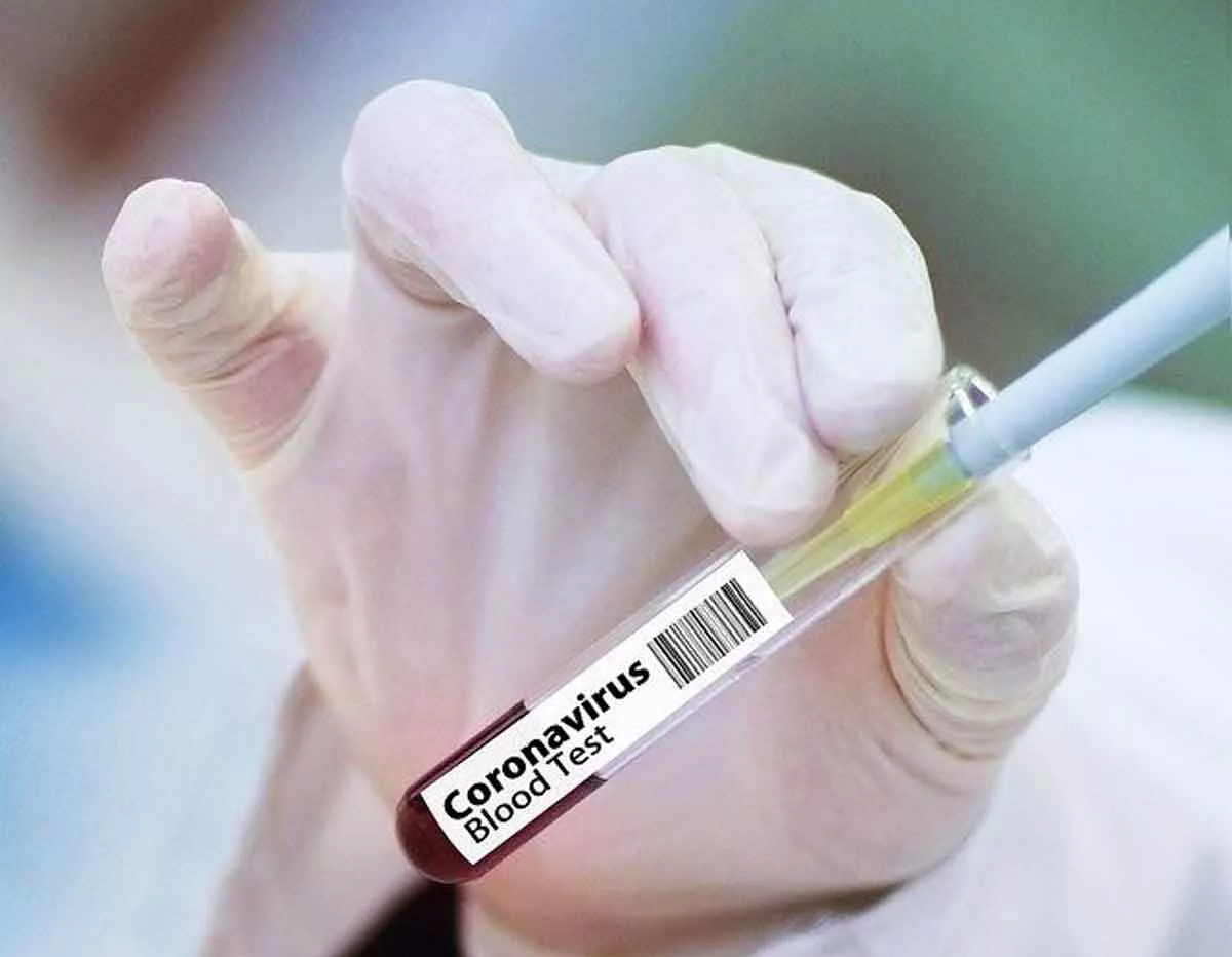 Kabar Baik! Vaksin Perusahaan Moderna Sukses Hasilkan Antibodi Covid-19