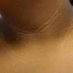 5 Bahan Alami Cegah Leher Hitam Saat Anda Hamil