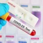 Dua Hari ‘Rapid Test’ Massal, 76 Warga Sampang Reaktif Covid-19