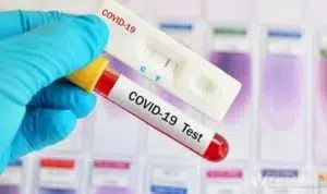 Dua Hari Rapid Test Massal, 76 Warga Sampang Reaktif Covid-19