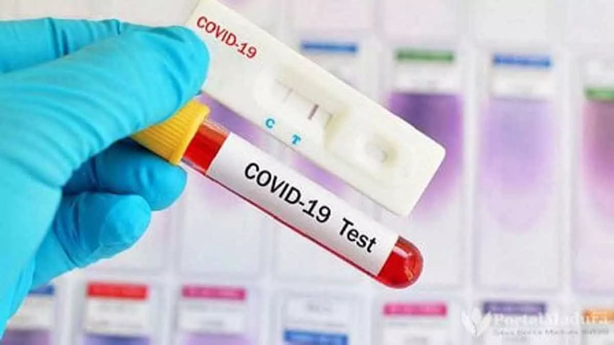 Dua Hari ‘Rapid Test’ Massal, 76 Warga Sampang Reaktif Covid-19
