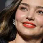 Bikin Iri, Fakta Unik yang Dimiliki Perempuan Berlesung Pipi