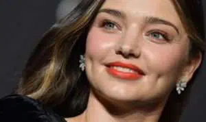 Bikin Iri, Fakta Unik yang Dimiliki Perempuan Berlesung Pipi