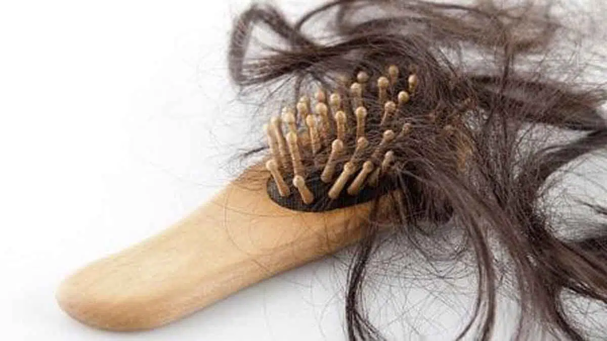 Ketahui 7 Hal Penyebab Rambut Anda Rontok