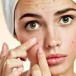 4 Manfat Retinol Untuk Kulit Wajah