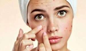 4 Manfat Retinol Untuk Kulit Wajah