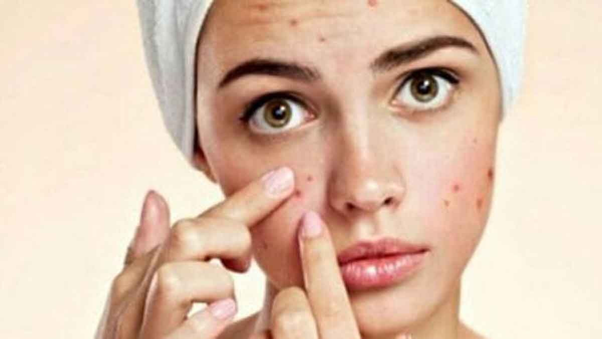 4 Manfat Retinol Untuk Kulit Wajah