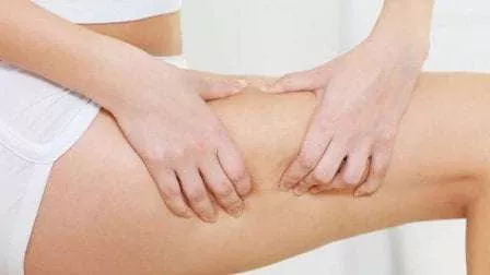 5 Cara Atasi Stretch Mark Pada Daerah Paha