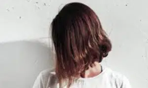 5 Bahan Alami Bantu Atasi Kebotakan Pada Rambut Anda