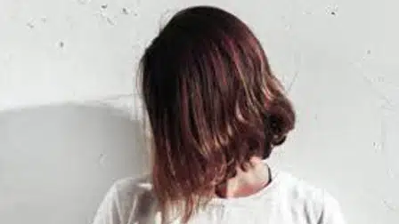 5 Bahan Alami Bantu Atasi Kebotakan Pada Rambut Anda