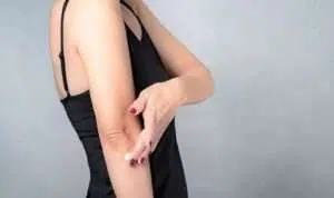 5 Cara Mudah Haluskan Kulit Siku yang Kasar