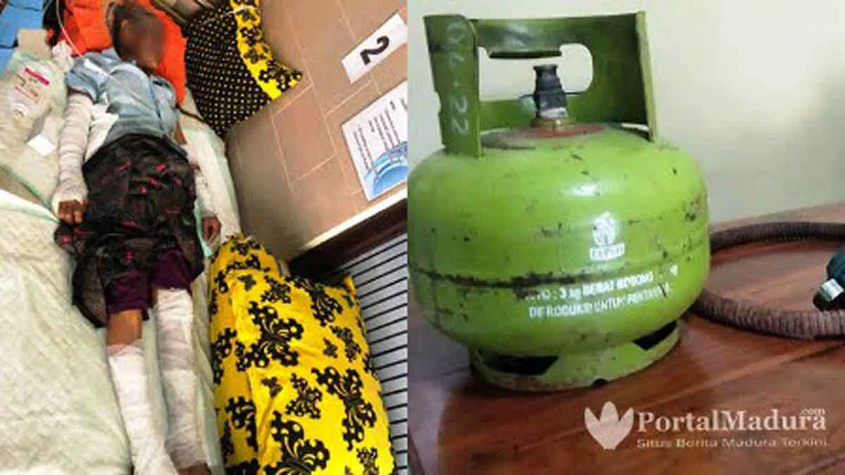 Korban ledakan tabung gas LPG menjalani perawatan medis di RSI garam Kalianget Sumenep (Humas Polres Sumenep)