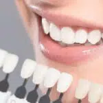 Penyebab Gusi Berwarna Hitam