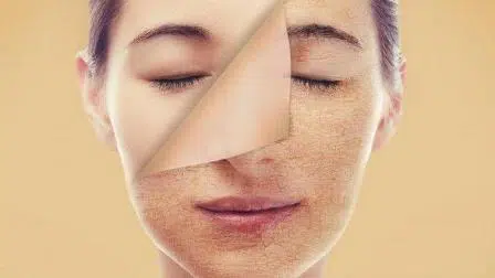 7 Cara Merawat Kulit Tetap Lembab Di Musim Panas