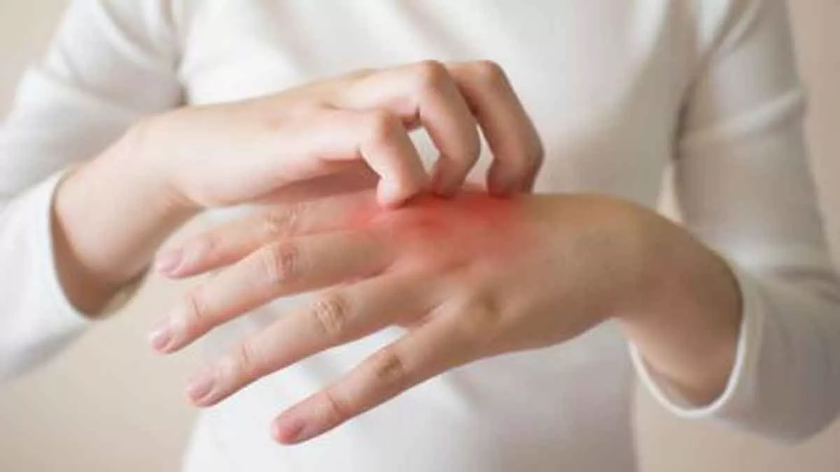 Berikut Cara Menghilangkan Jamur Kulit dengan Bumbu Dapur