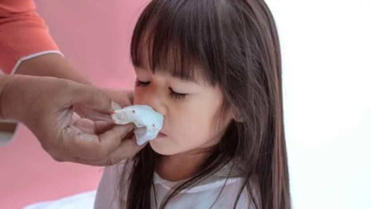 Berikut 4 Cara Mengatasi Mimisan pada Anak yang Wajib Anda Ketahui