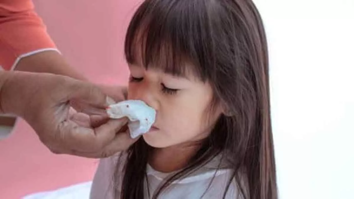 Berikut 4 Cara Mengatasi Mimisan pada Anak yang Wajib Anda Ketahui